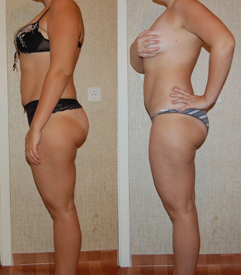 dieta-dlja-lenivyh-minus-12-kg-za-2-nedeli-otzyvy-4