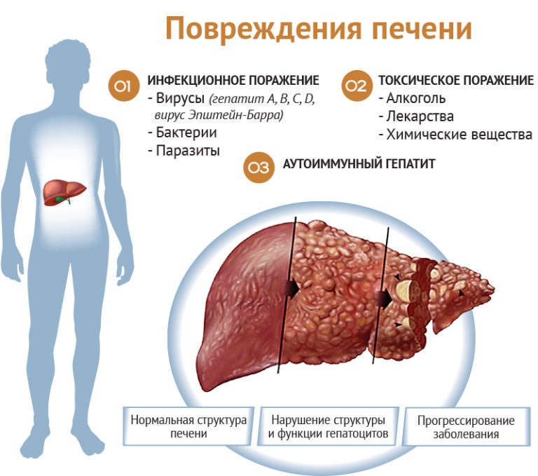 Причины, которые вызывают заболевание печени